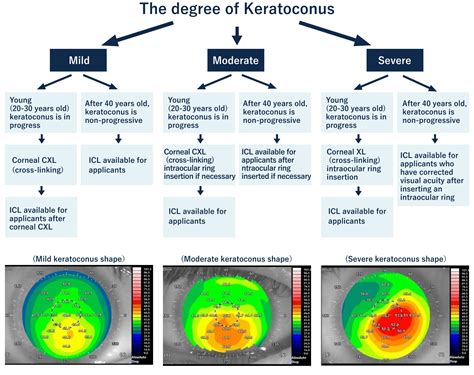Treatment For Keratoconus