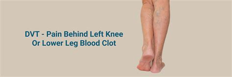 Pain Behind the Knee Blood Clot | Causes, Symptoms & Treatment