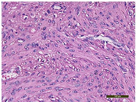 Spindle Shape 的图像结果