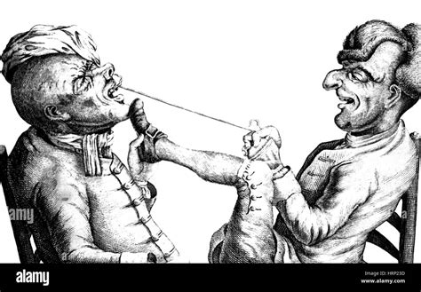 Image result for Medieval Tooth Extraction