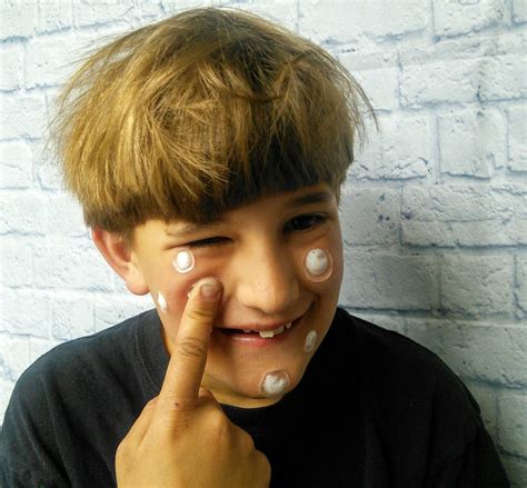 Image result for Exploding Zits 2019