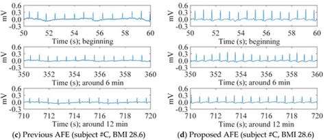 Sensors | Special Issue : ECG Sensors