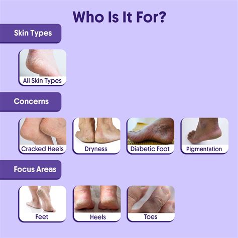 20% Urea Foot Roll-On | For Dry & Cracked Heels with Lactic & Glycolic ...