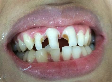 Agrawal Dental Clinic - Top Dentists & Dental Clinics in Allahabad Road ...