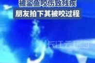 女子潜水被鲨鱼咬伤后遭网暴最新素材