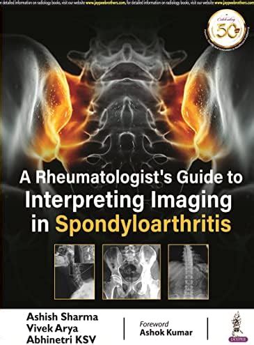 A RHEUMATOLOGIST’S GUIDE TO INTERPRETING IMAGING IN SPONDYLOARTHRITIS ...