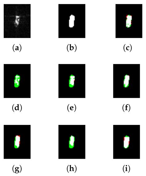 MtAD-Net: Multi-Threshold Adaptive Decision Net for Unsupervised ...