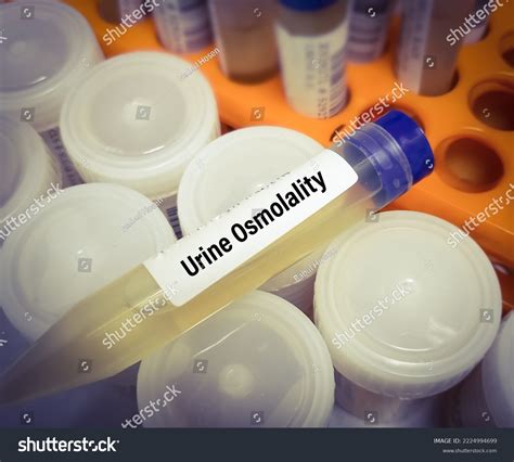 Osmolality Urine Quest at Jon Lefebre blog