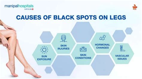 Black Spots on Legs: Symptoms, Causes and Treatment.pptx