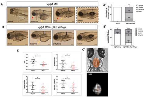 Cfdp1 Is Essential for Cardiac Development and Function