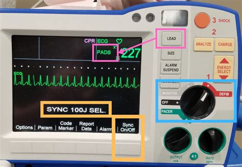 Image result for Synchronized Cardioversion Doses