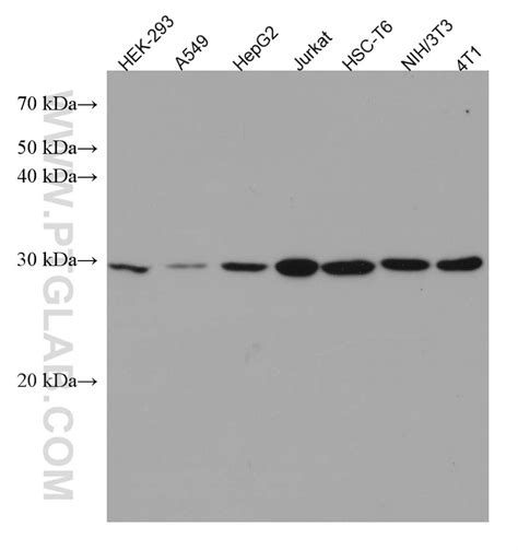 PSMD9 antibody (67338-1-Ig) | Proteintech
