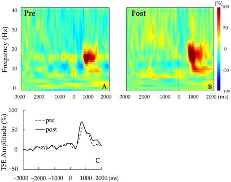 Does 20 Hz Transcranial Alternating Current Stimulation over the Human ...