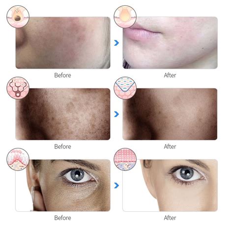 Image result for LED Mask Instructions