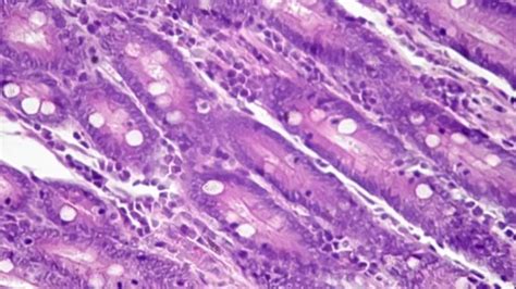 Image result for Jejunum Microscope