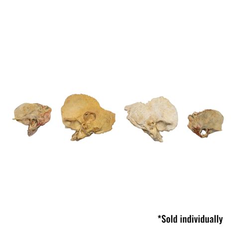 Real Human Child Temporal Bone For Sale — Skulls Unlimited ...