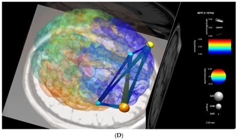 Signals | Special Issue : Advancing Signal Processing and Analytics of ...