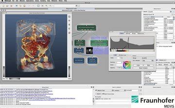 Image result for MeVisLab Connectors Triangle