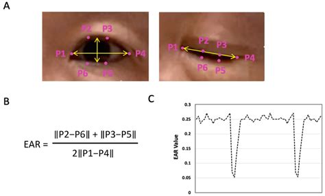 Image result for In-Ear Programming Model Example