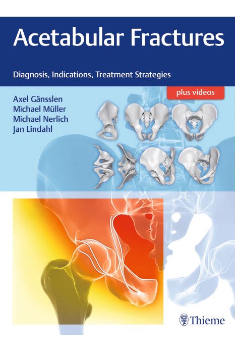 Acetabular Fractures