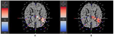 Individual Differences in the Neurocognitive Effect of Movement During ...