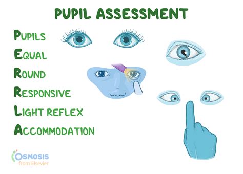 PERRLA: Pupil Assessment Acronym | Osmosis