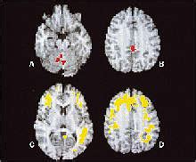 Image result for Brainwave Synchronization