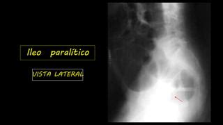 Image result for Nested Loop Patterns in Java