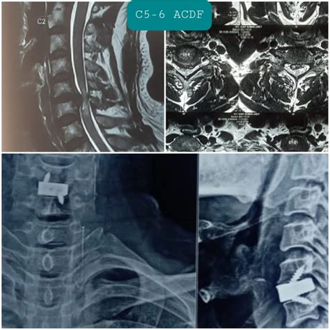 Photo Gallery - Dr Vivek Agrawal