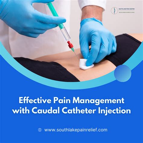 Catheter Pain When Sitting at Natalie Brigstocke blog