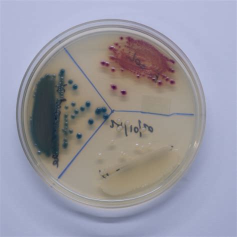 Microserv - MLRS - Microserv India - Microbiological Laboratory ...