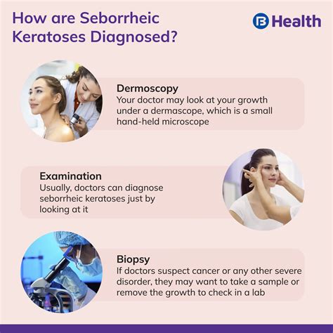 Seborrheic keratoses: Symptoms, Diagnosis and treatment
