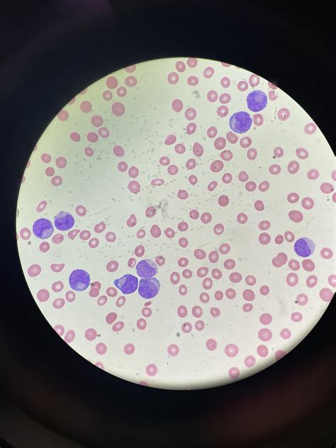 Granulocytes Immature Granulocyte Colony Stimulating Factor And