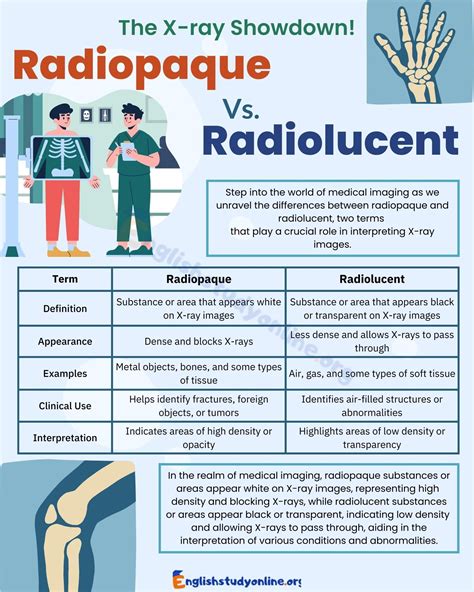 Radiopaque vs. Radiolucent: Demystifying the Terminology