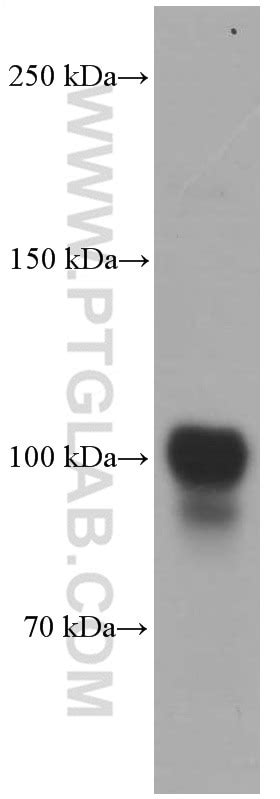PSMA/GCPII antibody (66678-1-Ig) | Proteintech