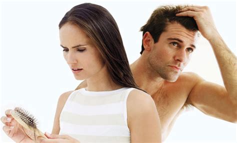 Overview Of Hair Loss | PRP for Hair Loss treatment | Hair Doctors