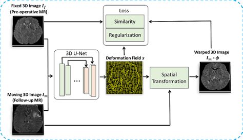 Image result for Using U Net for Deconvolution