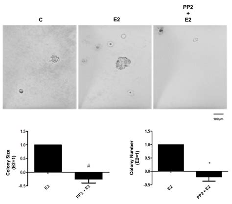 Estrogen Receptor Signaling Pathways Involved in Invasion and Colony ...