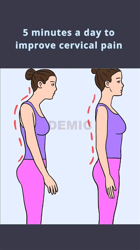 Image result for Forward Neck Position Tight Muscle Front