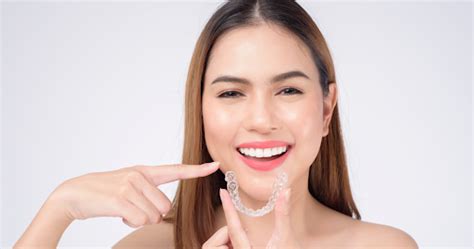 Clear Invisalign for Teens: The Definitive Guide