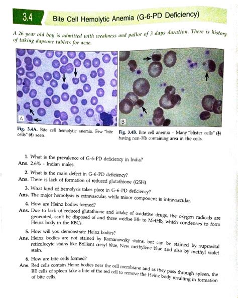 Adobe Scan 23-Oct-2022 - 3. Bite Cell Hemolytic Anemia (G-6-PD ...