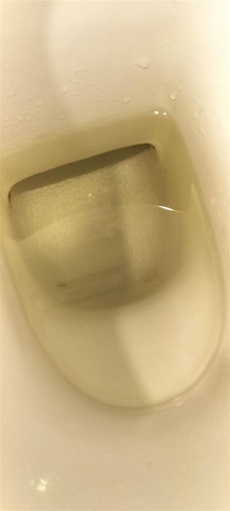 Why does my pee look like this : r/digestiveissues