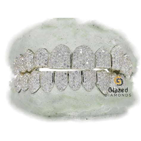 Fully Iced Out Moissanite Diamond Custom Grillz – Glazed Diamonds