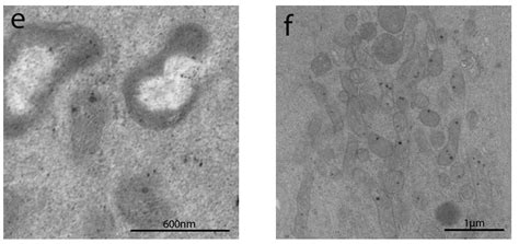 New Insights into Intestinal Permeability in Irritable Bowel Syndrome ...