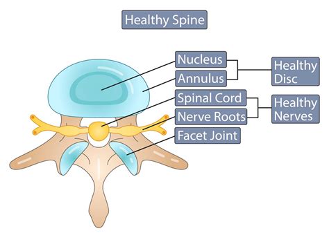 Bone Spurs Symptoms & Causes | What is a Bone Spur? | MNC