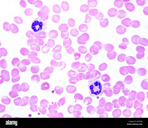 Human blood smear with band neutrophils, light micrograph Stock Photo ...