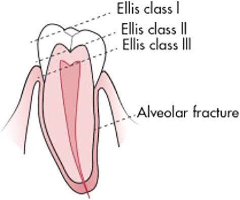 Image result for Graphical Abstract Examples of a Process