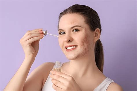 Serum for Open Pores and Acne | Clear Skin Solutions