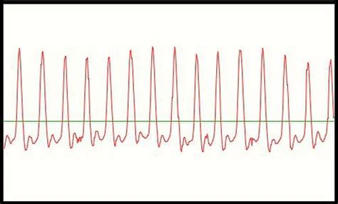 Image result for How to Read a Pulse Machine