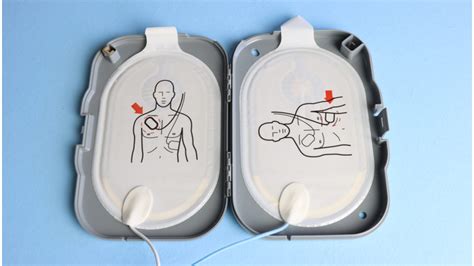 Can You Use Expired Defib Pads? The Risks Explained